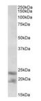 Interleukin 25 antibody, orb99073, Biorbyt, Western Blot image 