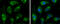 Pyruvate Dehydrogenase E1 Beta Subunit antibody, GTX119625, GeneTex, Immunocytochemistry image 