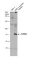 AT-Rich Interaction Domain 5A antibody, NBP2-43770, Novus Biologicals, Western Blot image 