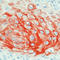 Keratin 17 antibody, LS-C88221, Lifespan Biosciences, Immunohistochemistry frozen image 