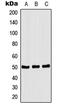 C-Terminal Src Kinase antibody, MBS822339, MyBioSource, Western Blot image 