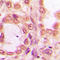 Pre-MRNA Processing Factor 19 antibody, LS-C353405, Lifespan Biosciences, Immunohistochemistry paraffin image 