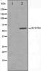 RCC1 And BTB Domain Containing Protein 1 antibody, orb224545, Biorbyt, Western Blot image 