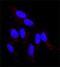 Fibroblast Growth Factor Receptor 2 antibody, GTX10648, GeneTex, Immunofluorescence image 
