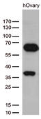 Kruppel Like Factor 11 antibody, M04277, Boster Biological Technology, Western Blot image 