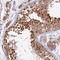 WD Repeat Domain 61 antibody, NBP1-80845, Novus Biologicals, Immunohistochemistry frozen image 