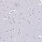 Ribonuclease A Family Member 3 antibody, PA5-63260, Invitrogen Antibodies, Immunohistochemistry frozen image 