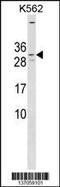 Potassium Voltage-Gated Channel Subfamily E Regulatory Subunit 4 antibody, 59-910, ProSci, Western Blot image 