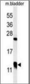 Cysteine-rich protein 1 antibody, orb322995, Biorbyt, Western Blot image 