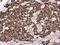 General Transcription Factor IIB antibody, NBP1-32622, Novus Biologicals, Immunohistochemistry paraffin image 