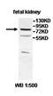 IQ Motif Containing With AAA Domain 1 antibody, orb78007, Biorbyt, Western Blot image 