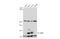 Ubiquitin Specific Peptidase 1 antibody, GTX130252, GeneTex, Western Blot image 