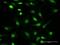 Protein Phosphatase 1 Catalytic Subunit Gamma antibody, H00005501-B02P, Novus Biologicals, Immunocytochemistry image 
