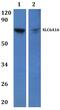 Solute Carrier Family 6 Member 16 antibody, PA5-75896, Invitrogen Antibodies, Western Blot image 