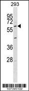 G Protein-Coupled Receptor 37 antibody, 62-273, ProSci, Western Blot image 