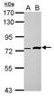 Zinc Finger BED-Type Containing 8 antibody, PA5-32073, Invitrogen Antibodies, Western Blot image 