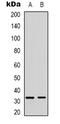 Forkhead Box E3 antibody, LS-C368666, Lifespan Biosciences, Western Blot image 