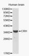 Corticotropin Releasing Hormone antibody, abx001037, Abbexa, Western Blot image 