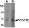 Coiled-Coil Domain Containing 22 antibody, LS-B8841, Lifespan Biosciences, Western Blot image 