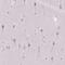 UTP4 Small Subunit Processome Component antibody, PA5-59445, Invitrogen Antibodies, Immunohistochemistry paraffin image 