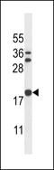 Stathmin-3 antibody, 56-799, ProSci, Western Blot image 