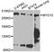 Myosin-X antibody, A12466, ABclonal Technology, Western Blot image 