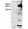 Erb-B2 Receptor Tyrosine Kinase 4 antibody, F48403-0.4ML, NSJ Bioreagents, Western Blot image 