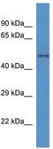 Solute Carrier Family 35 Member F3 antibody, TA334616, Origene, Western Blot image 