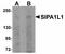 Signal Induced Proliferation Associated 1 Like 1 antibody, orb94342, Biorbyt, Western Blot image 