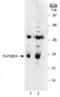 15-hydroxyprostaglandin dehydrogenase [NAD+] antibody, PA1-16666, Invitrogen Antibodies, Western Blot image 