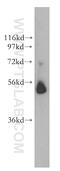 Galactosylceramidase antibody, 51049-2-AP, Proteintech Group, Western Blot image 