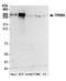 Tetratricopeptide Repeat Domain 28 antibody, A304-636A, Bethyl Labs, Western Blot image 