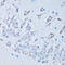 Nicotinamide N-Methyltransferase antibody, 22-396, ProSci, Immunohistochemistry paraffin image 