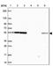 Eukaryotic Translation Initiation Factor 3 Subunit D antibody, NBP2-38990, Novus Biologicals, Western Blot image 