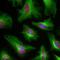 Tubulin Beta 4A Class IVa antibody, M05613-3, Boster Biological Technology, Immunohistochemistry paraffin image 