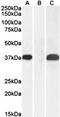 Pim-2 Proto-Oncogene, Serine/Threonine Kinase antibody, orb137118, Biorbyt, Western Blot image 
