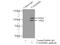 Family With Sequence Similarity 160 Member B1 antibody, 25388-1-AP, Proteintech Group, Enzyme Linked Immunosorbent Assay image 