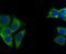 Ubiquitin Specific Peptidase 10 antibody, NBP2-75698, Novus Biologicals, Immunocytochemistry image 