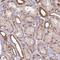 General Transcription Factor IIH Subunit 3 antibody, HPA004844, Atlas Antibodies, Immunohistochemistry paraffin image 