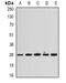 Calpain small subunit 1 antibody, orb341106, Biorbyt, Western Blot image 