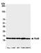 Ubiquitin Conjugating Enzyme E2 A antibody, A300-281A, Bethyl Labs, Western Blot image 