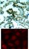 Protein Kinase C Beta antibody, 79-183, ProSci, Immunofluorescence image 