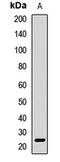 Amyloid P Component, Serum antibody, LS-C668020, Lifespan Biosciences, Western Blot image 