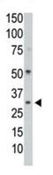 Protein Phosphatase 1 Catalytic Subunit Gamma antibody, abx033948, Abbexa, Western Blot image 