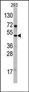 Vascular Endothelial Growth Factor D antibody, AP13297PU-N, Origene, Western Blot image 