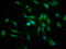 Prolylcarboxypeptidase antibody, LS-C670625, Lifespan Biosciences, Immunofluorescence image 