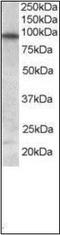 Forkhead Box O3 antibody, orb89290, Biorbyt, Western Blot image 