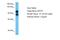 Protein Phosphatase 1 Regulatory Subunit 12B antibody, A11318, Boster Biological Technology, Western Blot image 