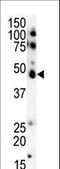 Casein Kinase 1 Epsilon antibody, LS-C100599, Lifespan Biosciences, Western Blot image 