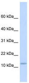 Plasminogen Receptor With A C-Terminal Lysine antibody, TA331041, Origene, Western Blot image 